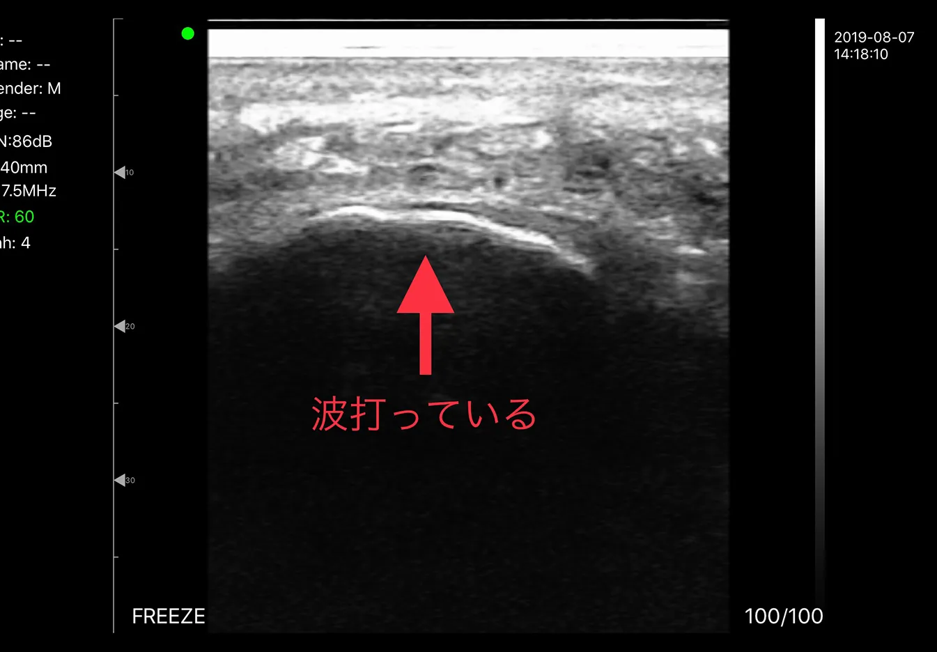 エコー検査の詳細