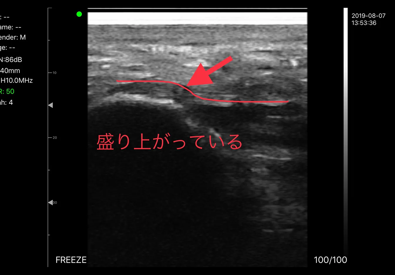 エコー検査の詳細